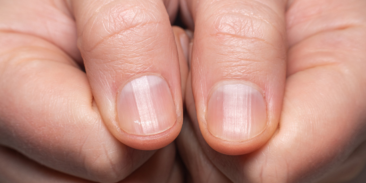 По ногтям определить болезнь человека на руках фото