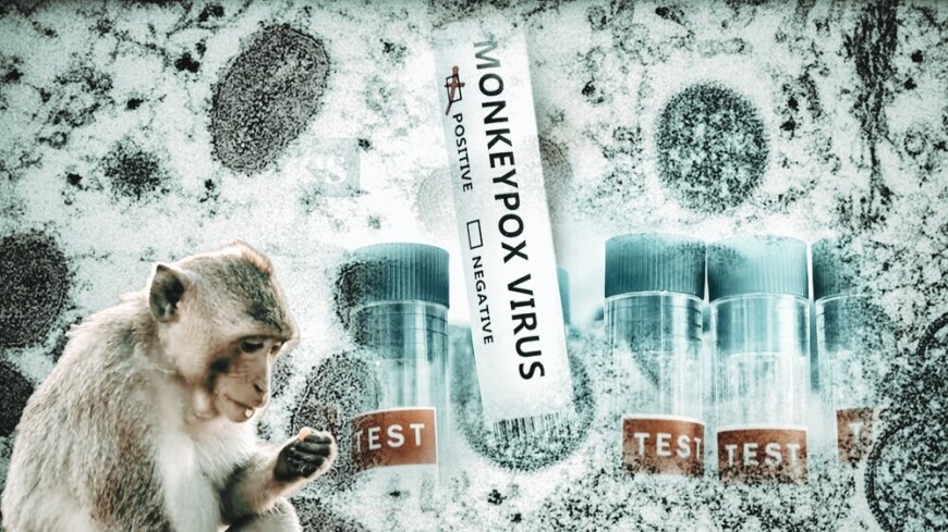 Новые тест-системы для выявления обезьяньей оспы созданы в технополисе «Москва»