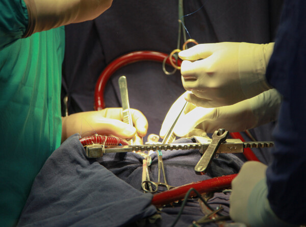 Подмосковные врачи удалили из щеки женщины 12-сантиметрового гельминта