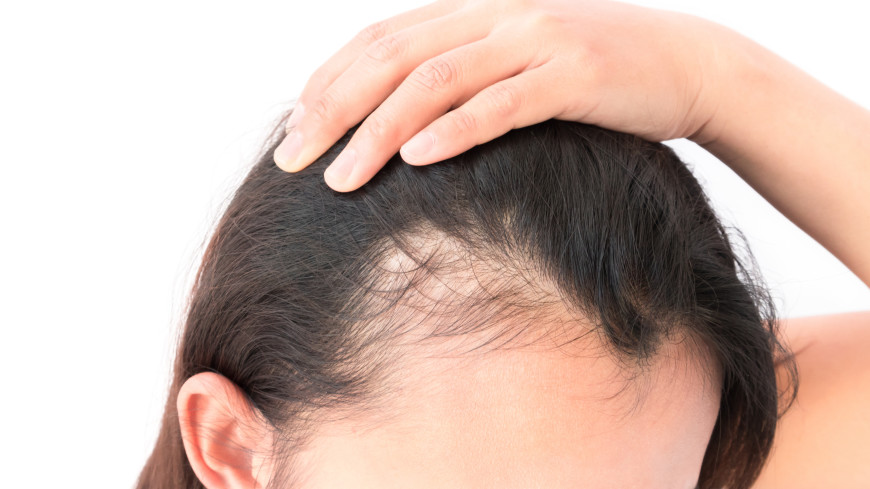 Какие продукты помогут остановить выпадение волос?