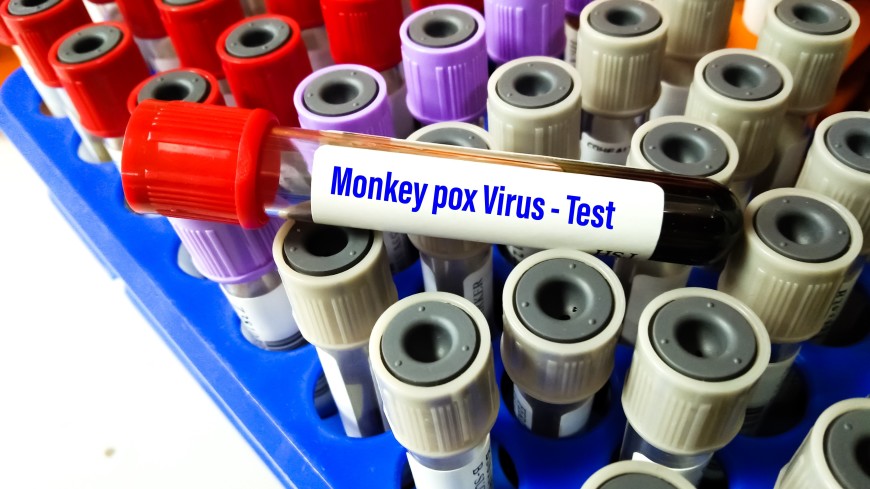 Вирусолог рассказал, может ли оспа обезьян распространиться так же, как ковид