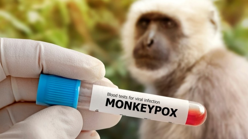 У двух детей в США выявили оспу обезьян