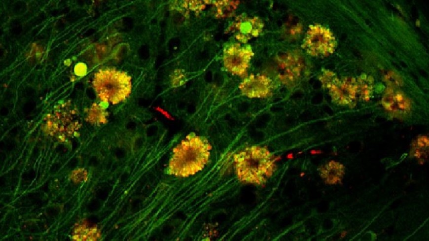 Развитие болезни Альцгеймера связали с «ядовитыми цветами» в мозге