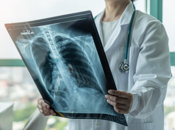 «Практически каждый заражен туберкулезом»: врачи ответили на главные вопросы об этом заболевании
