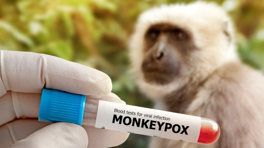 ВОЗ намерена переименовать обезьянью оспу в MPOX