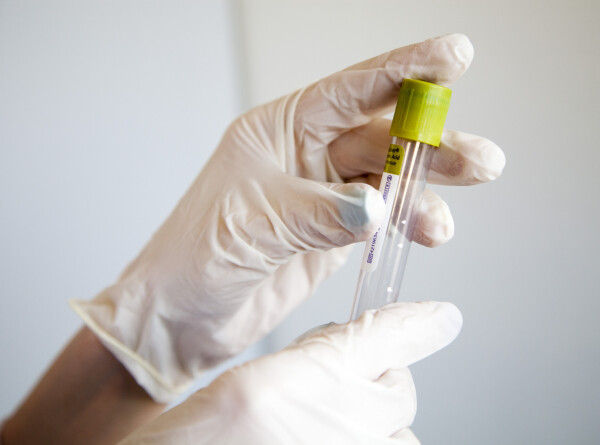 Доклинические испытания вакцины от аллергии на березу завершат в России в 2023 году
