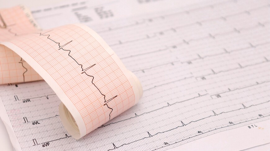 Российские ученые создали «кардиопластырь» для мониторинга работы сердца