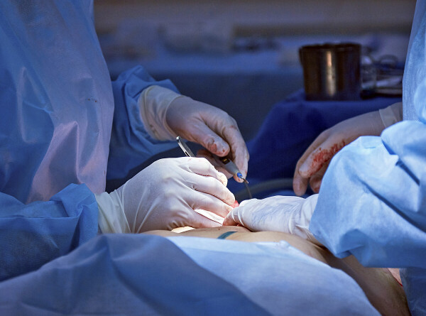 Кардиохирурги за одну операцию починили сосуды и заменили клапан сердца