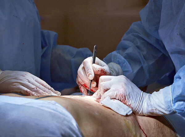 Манекен с органами животных для обучения хирургов изобрели российские ученые