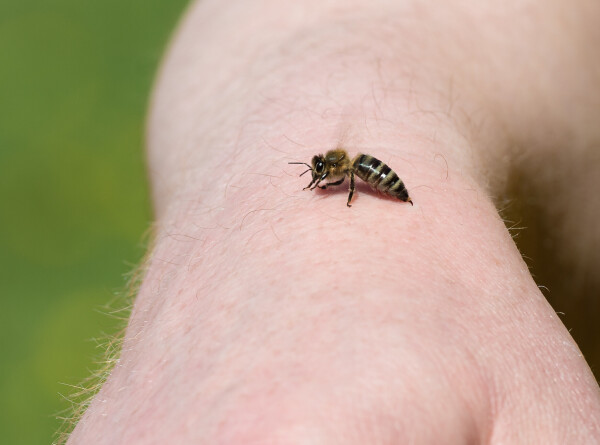 Что делать после укуса пчелы, объяснил врач