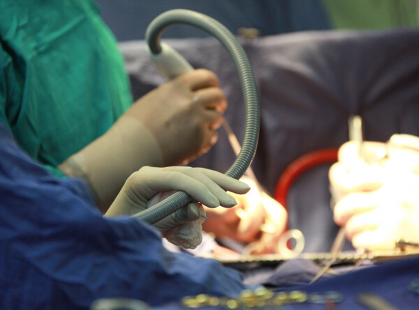 Хирурги впервые пересадили сердечный насос и почку свиньи живому человеку