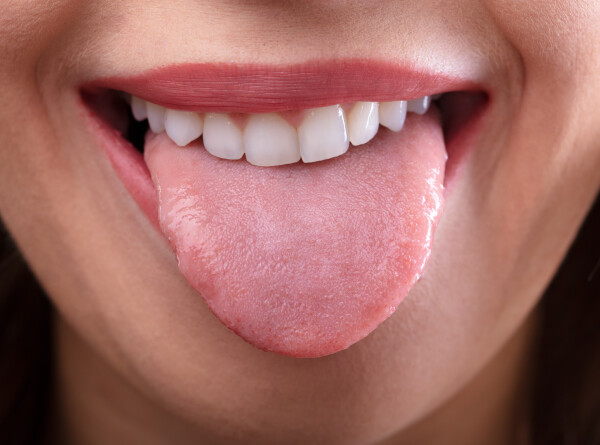 Зачем чистить язык, рассказал стоматолог