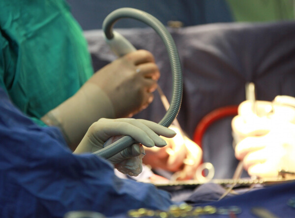 Титановое сердце с магнитной подвеской впервые имплантировали пациенту