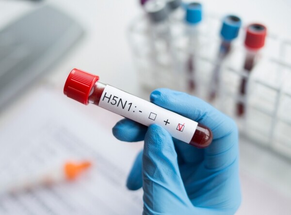 12 случаев заражения человека птичьим гриппом зарегистрировано в США с начала года