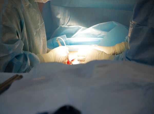 Опухоль весом 14 килограммов удалили пациентке в Подмосковье
